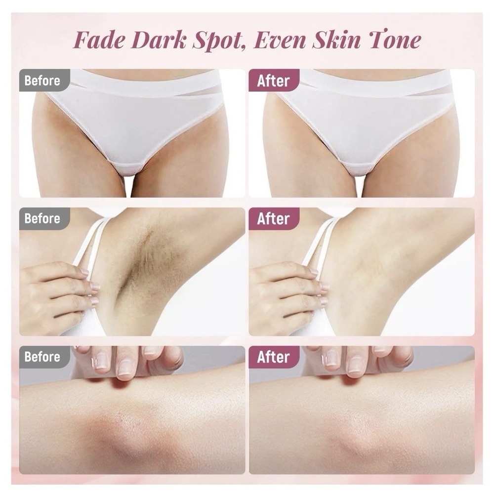 Skin Lightening Cream for Intimate Area Dark Spot Remover Skin Whitening Cream - Picture 4 of 8